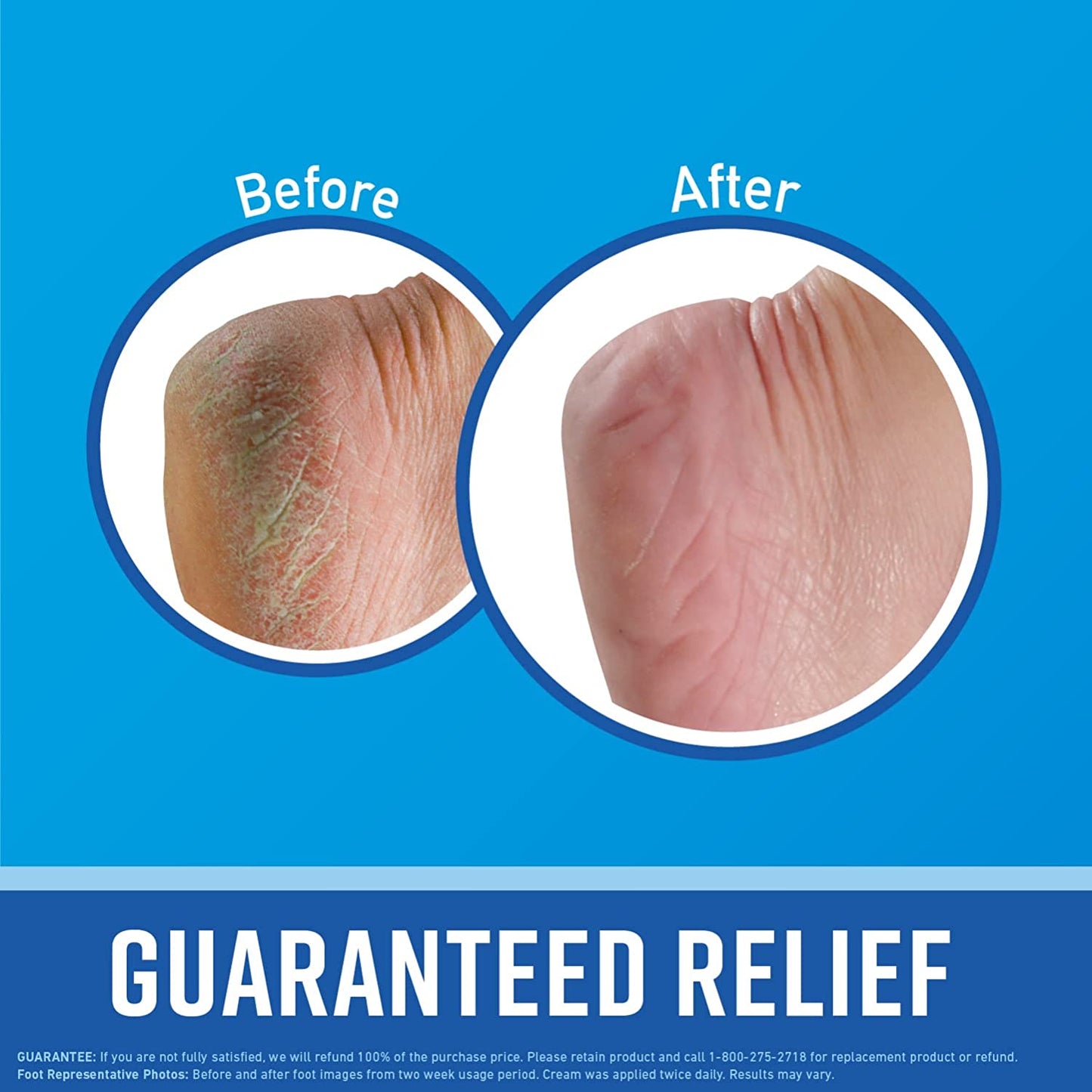 Healthy Feet Foot Cream - Effective Relief for Extremely Dry and Cracked Feet - Instant Moisture Boost - 3.2 Ounce Jar (Pack of 3)